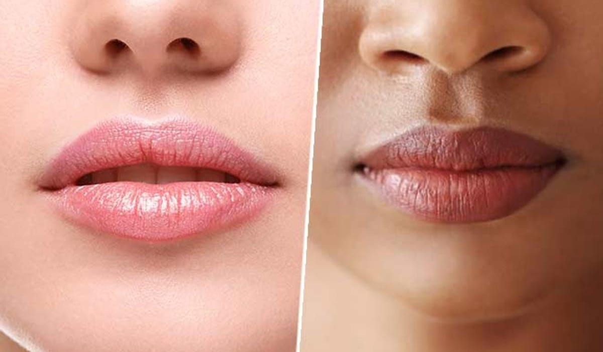 ડાર્ક લિપ્સથી મેળવો છુટકારો