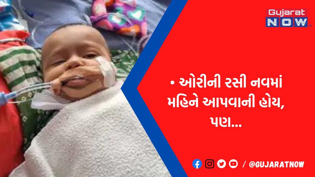 6 થી 7 માસના શિશુઓને પણ ઓરી થતાં તબીબો ચોંક્યા રોજના 15 કેસો : WHO જેેનેટિકલ એનાલિસિસ કરશે