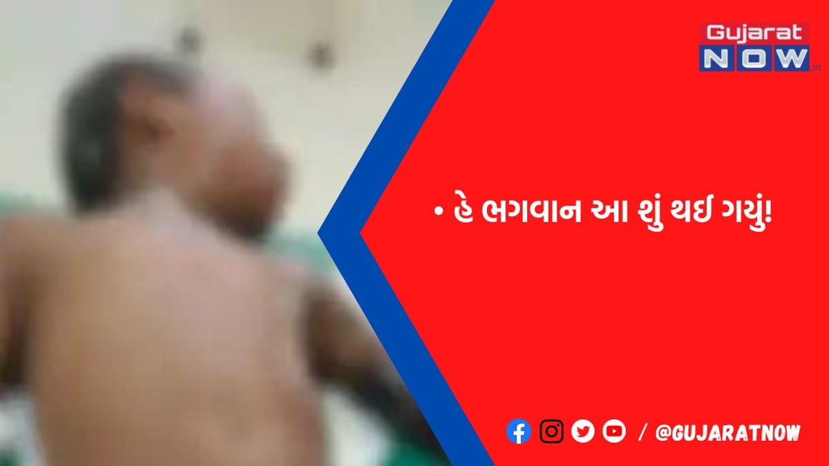 અંકલેશ્વરના સારંગપુર ગામમાં આવેલી મારુતિધામ 2માં વીજ કરંટ લાગતા બે બાળકો દાઝ્યા
