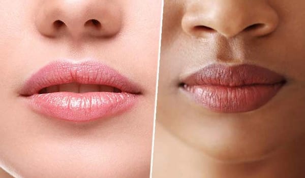 ડાર્ક લિપ્સથી મેળવો છુટકારો