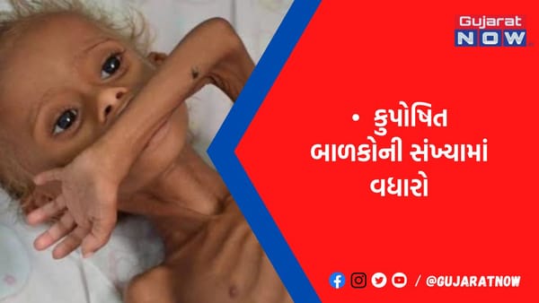 રાજકોટ જિલ્લામાં છેલ્લા 5 વર્ષમાં 20310 જ્યારે નવા વર્ષની શરૂઆતના એક માસમાં જ 531 કુપોષિત બાળકો નોંધાયા