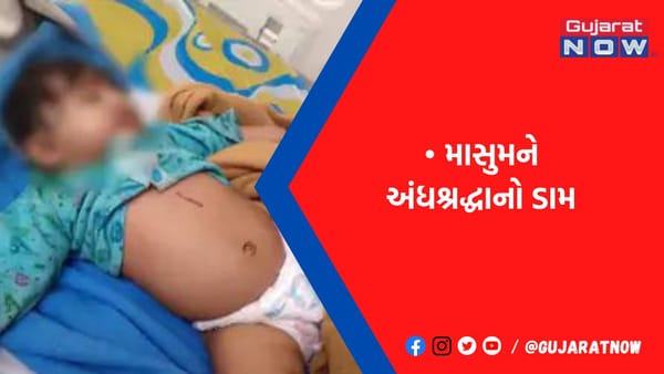 બખરલા ગામે 2 માસની બાળકીને ભુવાએ ડામ દીધો
