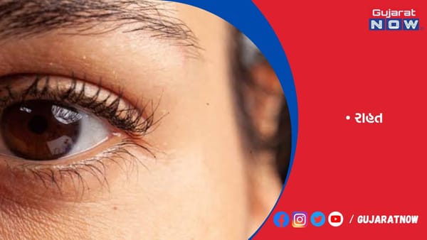 રાજકોટમાં કંજંક્ટિવાઈટિસના કેસમાં ક્રમશ રાહત, મનપાના ચોપડે 19000 દર્દી નોંધાયા
